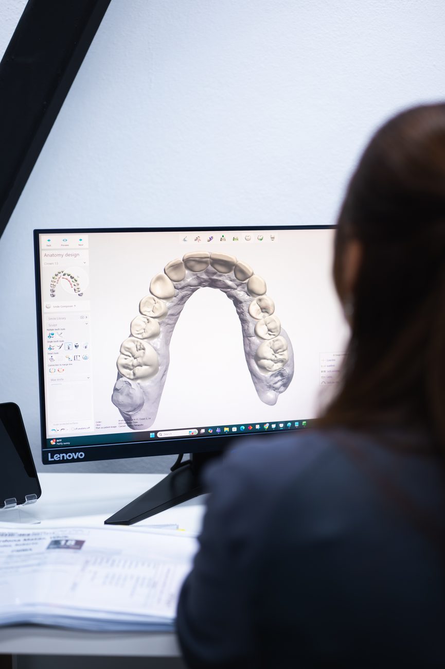 Intraoral scanning at DDS Caribbean
